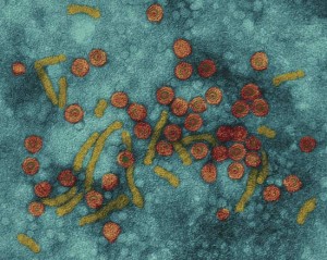 Hepatitis B Virus