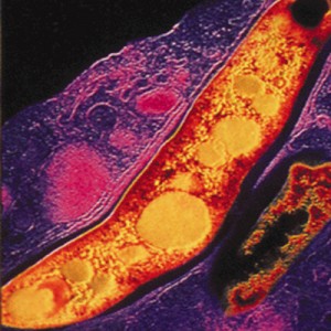 Tuberculosis Bacterium