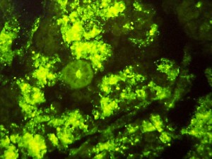 The Rabies Virus