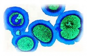 The Yellow Fever Virus