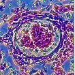 The iphtheria Virus